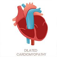 cardiomyopathies-and-heart-failure-management