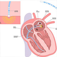 Electrophysiology problems